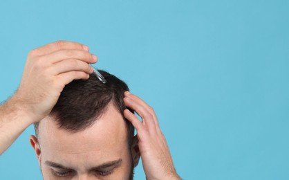 Photo of Baldness treatment. Man applying serum onto hair on light blue background, closeup. Space for text