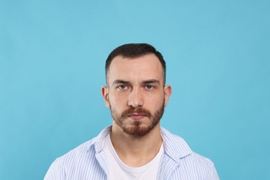 Baldness problem. Man with receding hairline on light blue background