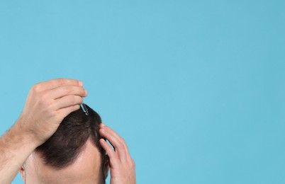 Photo of Baldness treatment. Man applying serum onto hair on light blue background, closeup. Space for text