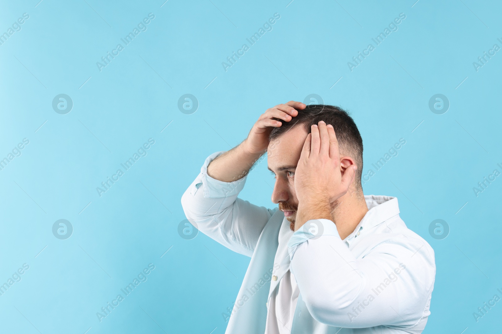 Photo of Baldness problem. Man with receding hairline on light blue background, space for text