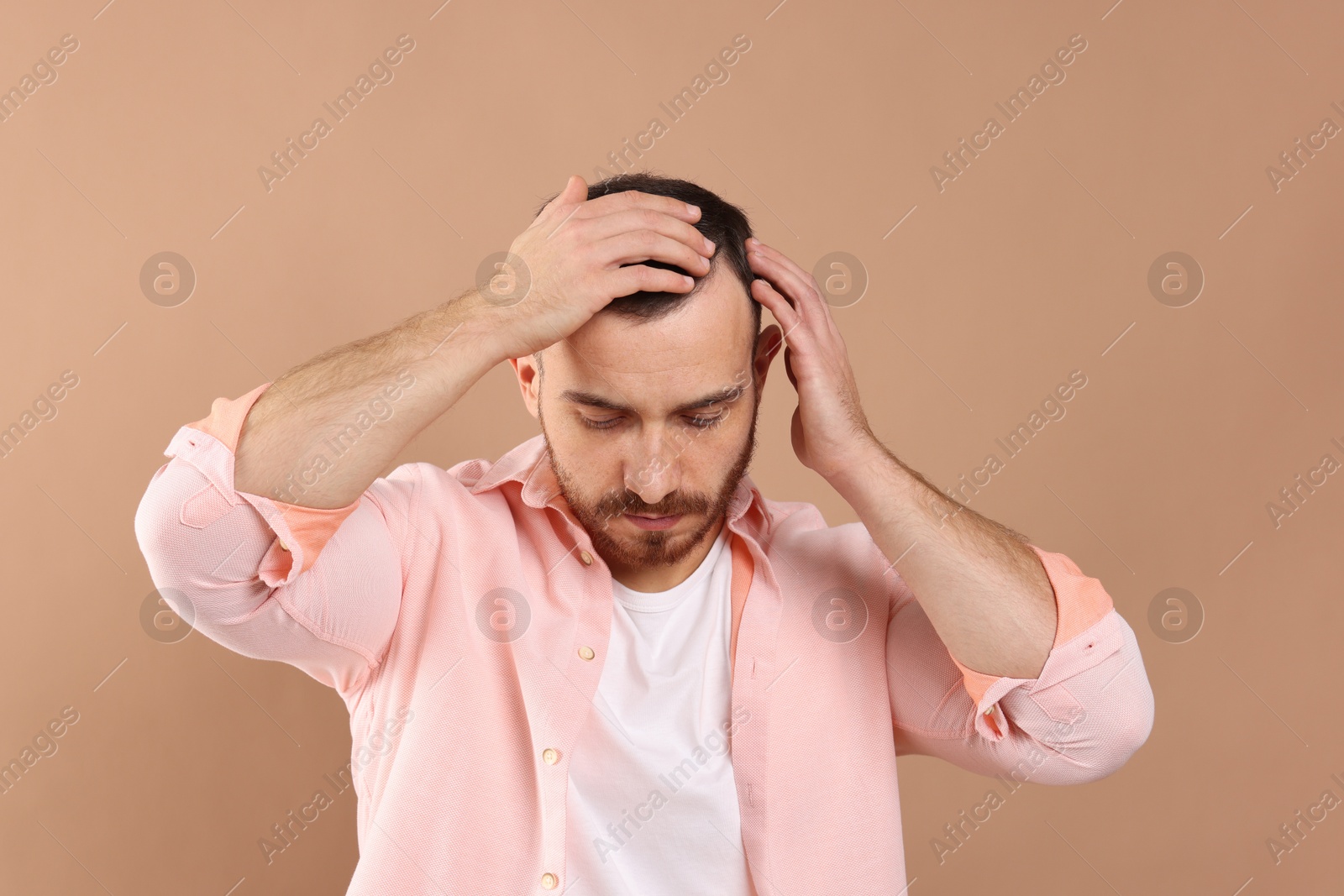 Photo of Baldness problem. Man with receding hairline on beige background