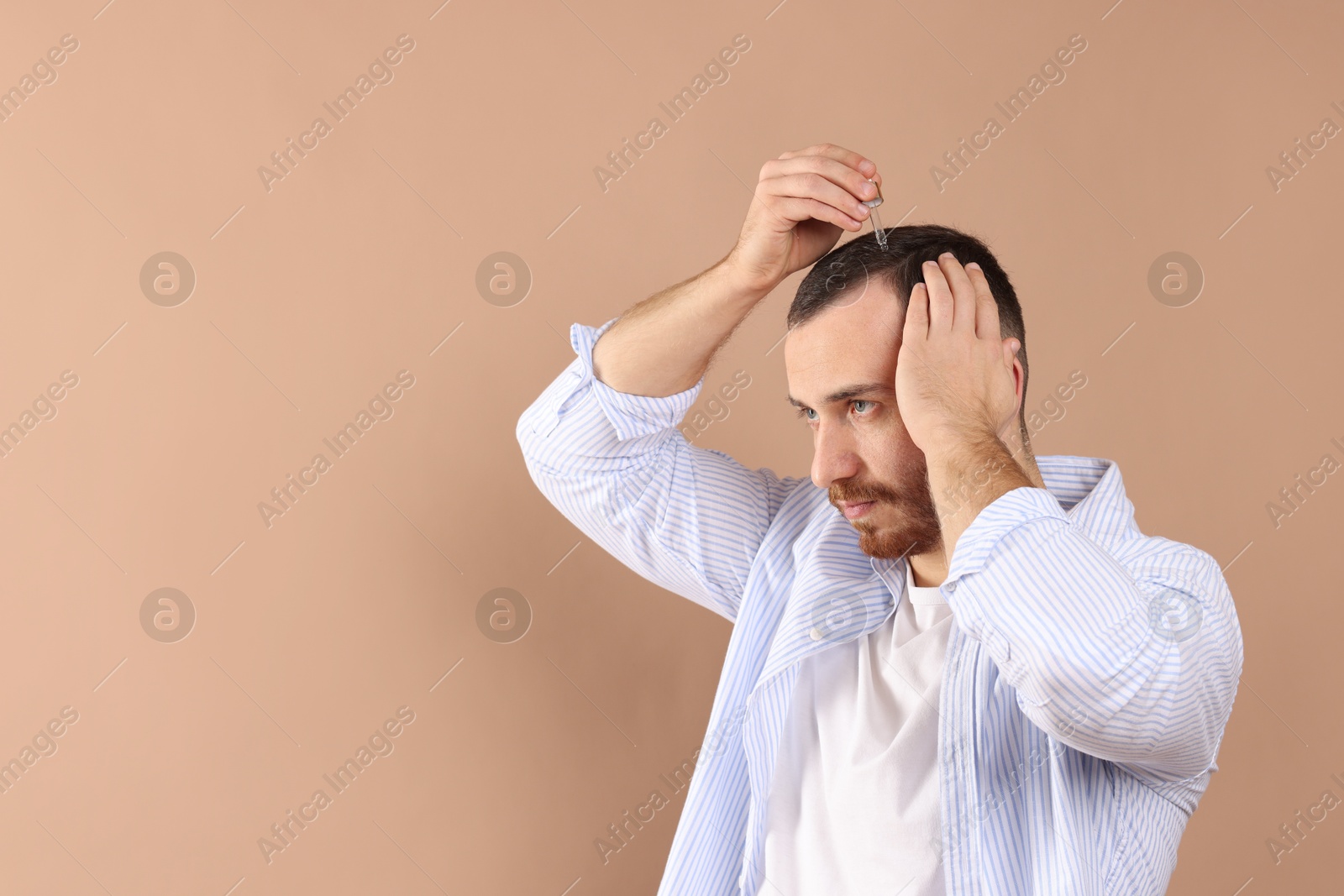 Photo of Baldness treatment. Man applying serum onto hair on beige background, space for text