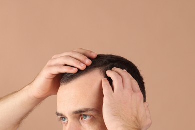 Baldness problem. Man with receding hairline on beige background, closeup