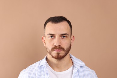 Photo of Baldness problem. Man with receding hairline on beige background