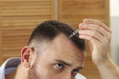 Photo of Baldness treatment. Man applying serum onto hair at home, closeup