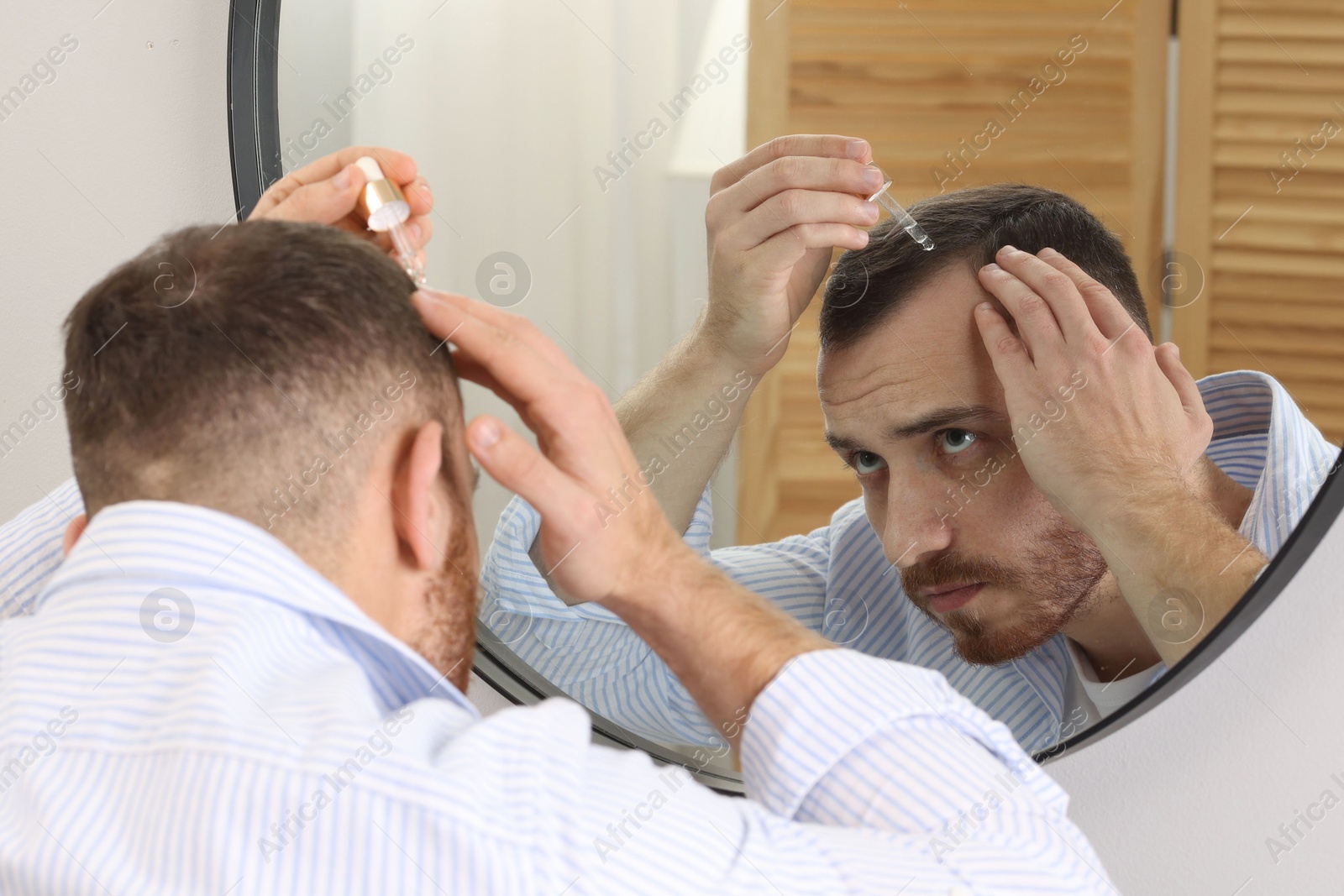 Photo of Baldness treatment. Man applying serum onto hair near mirror at home