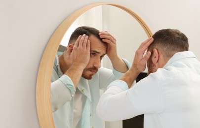 Baldness problem. Man with receding hairline near mirror at home