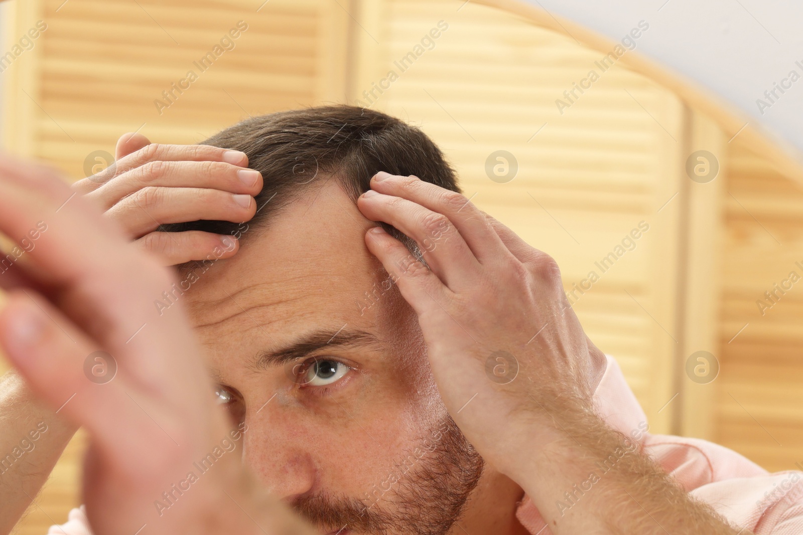 Photo of Baldness problem. Man with receding hairline near mirror at home