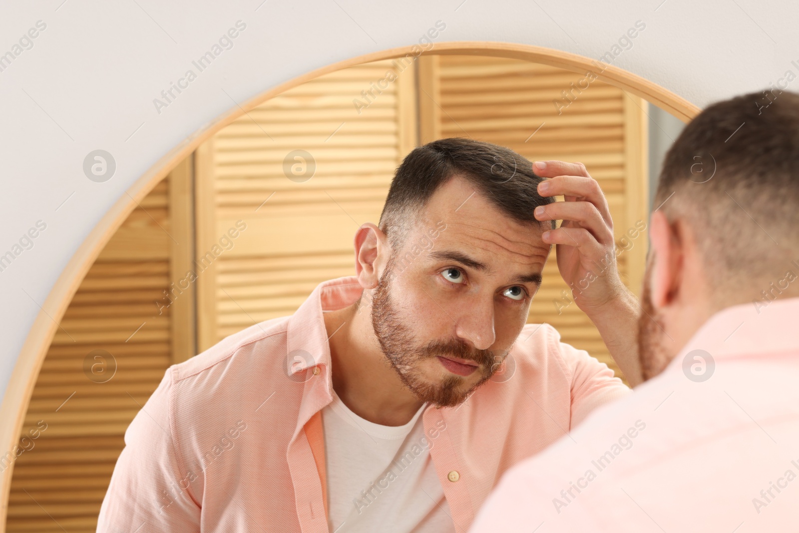 Photo of Baldness problem. Man with receding hairline near mirror at home