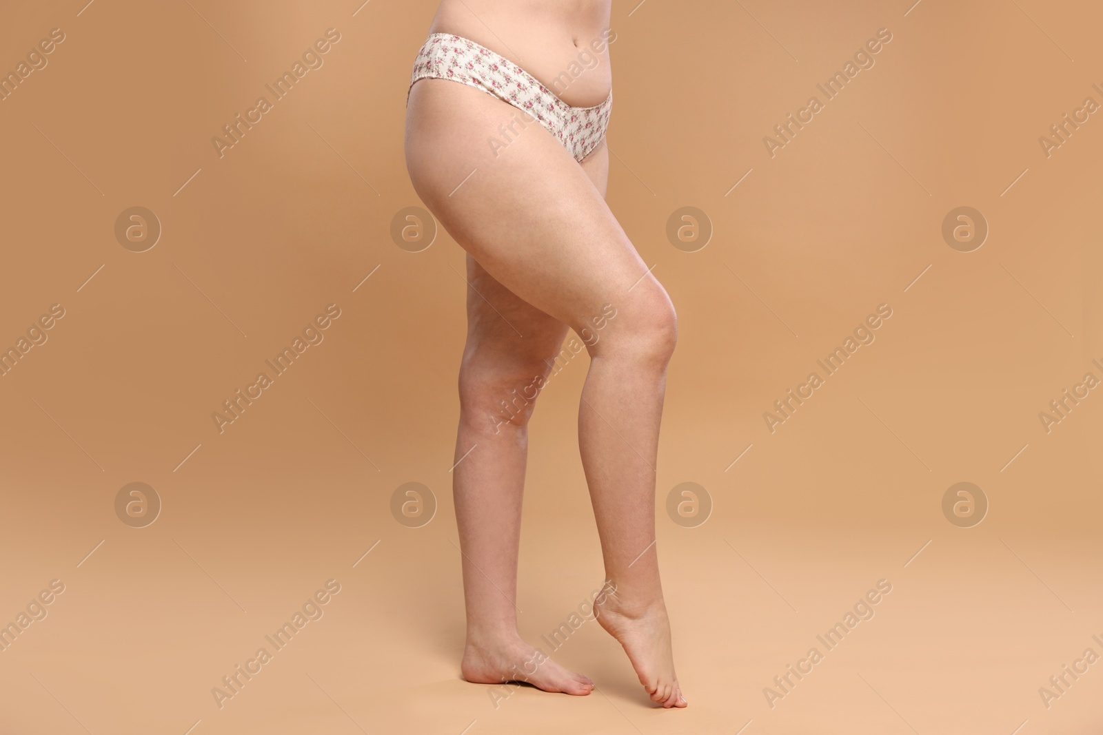 Photo of Woman with cellulite on dark beige background, closeup