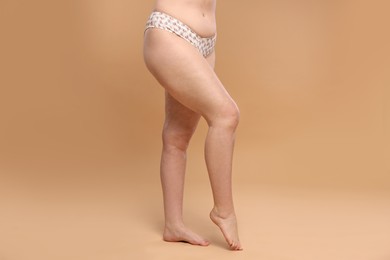 Photo of Woman with cellulite on dark beige background, closeup