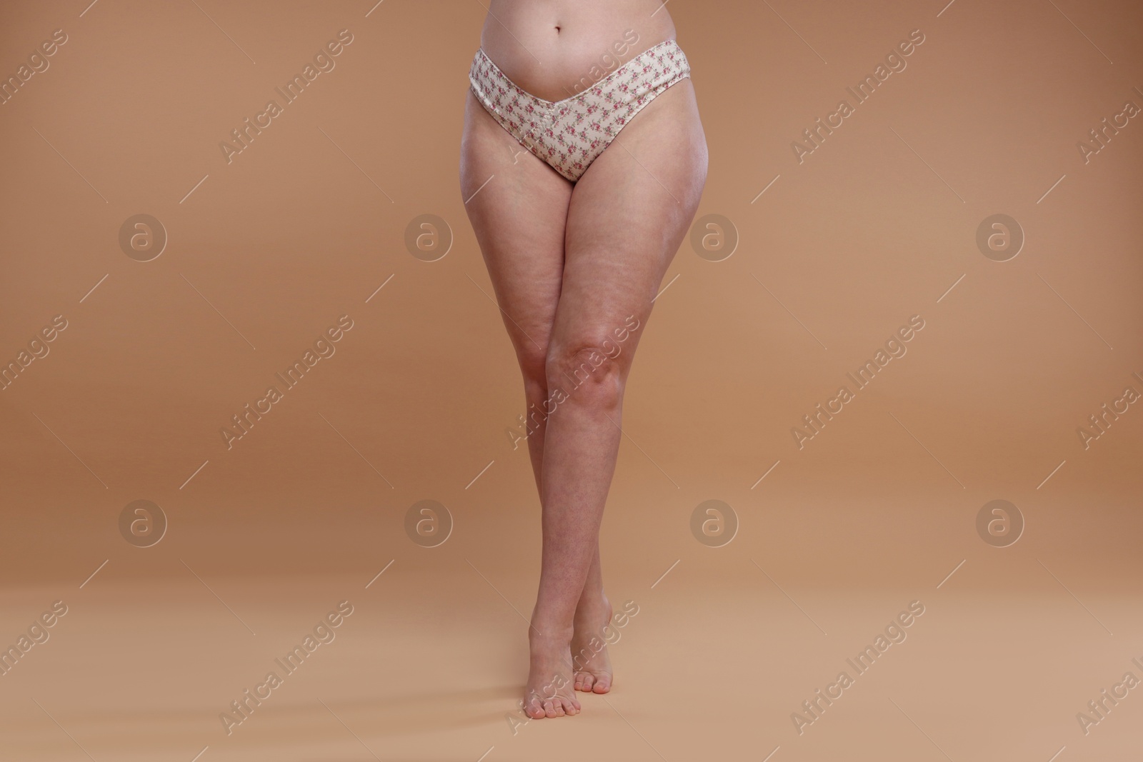 Photo of Woman with cellulite on dark beige background, closeup