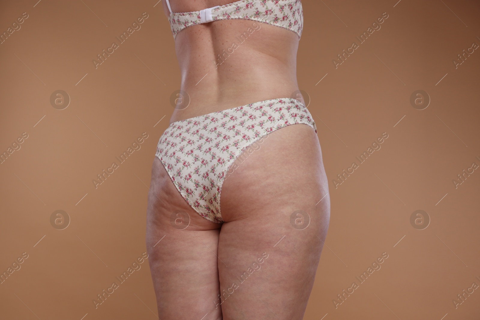 Photo of Woman with cellulite on dark beige background, closeup