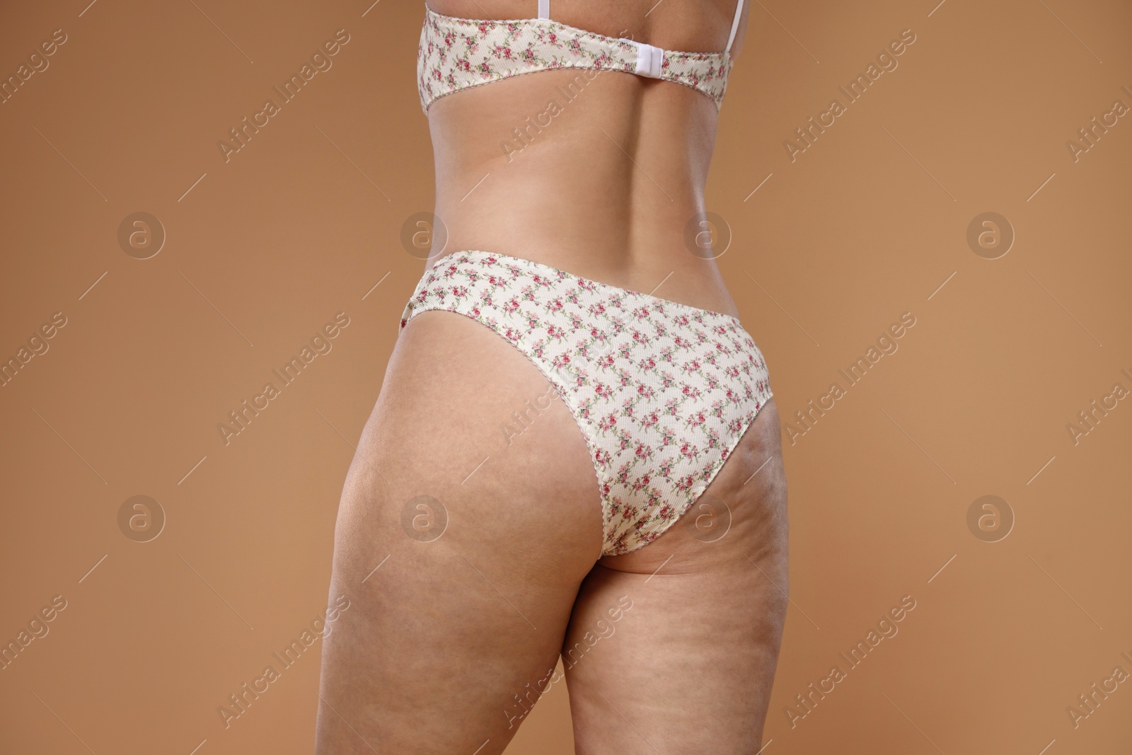 Photo of Woman with cellulite on dark beige background, closeup