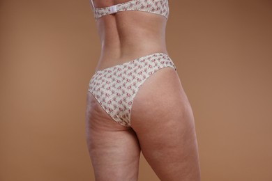 Photo of Woman with cellulite on dark beige background, closeup