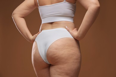 Photo of Woman with cellulite on brown background, closeup