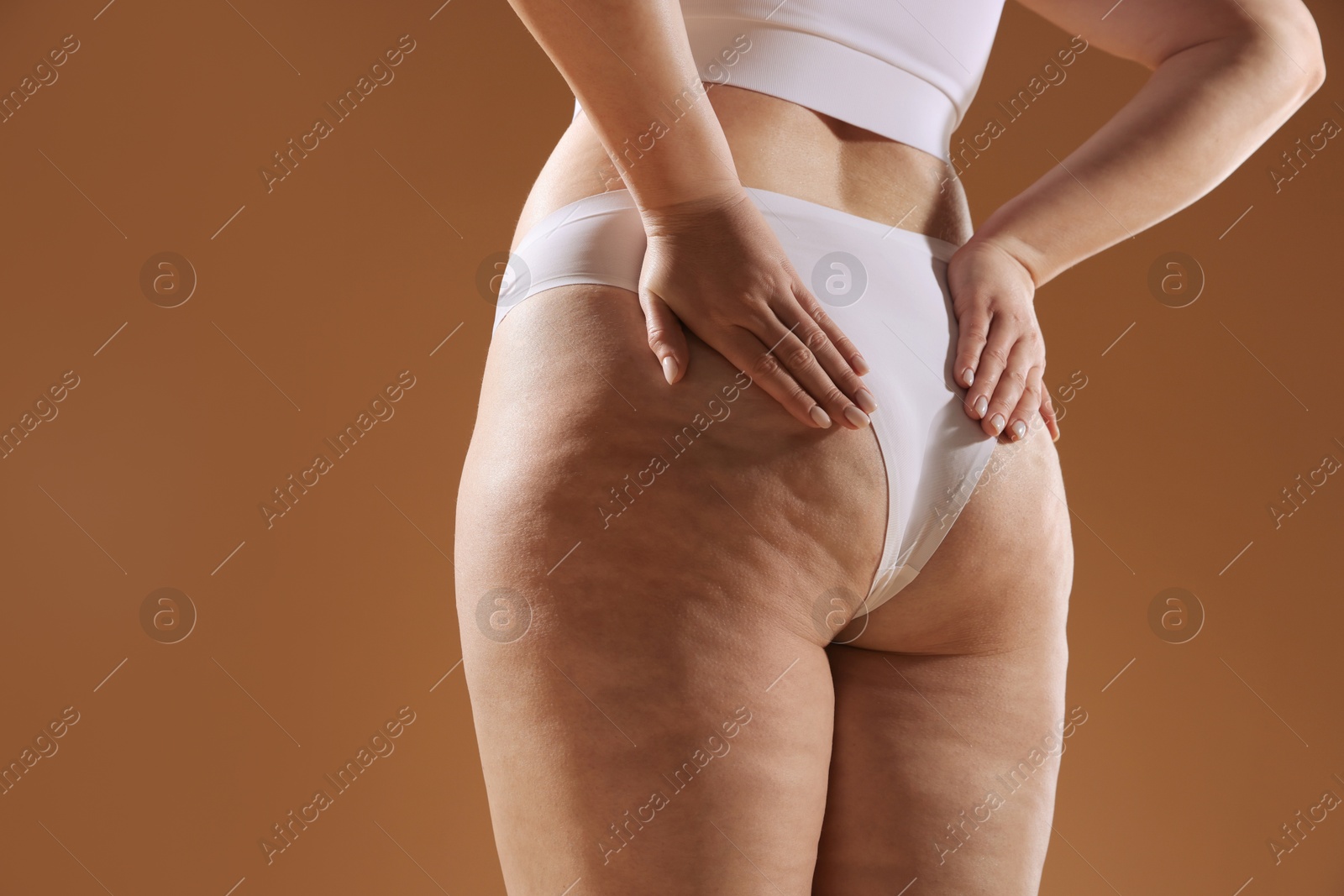 Photo of Woman with cellulite problem on brown background, closeup