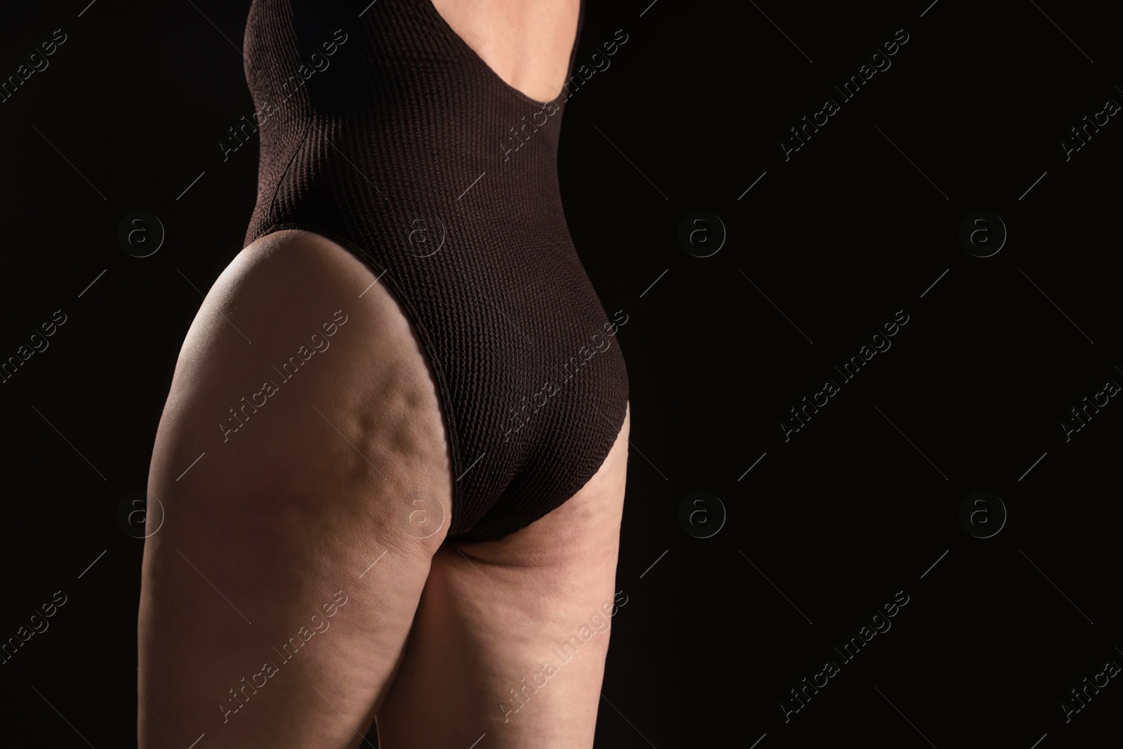 Photo of Woman with cellulite problem on black background, closeup. Space for text