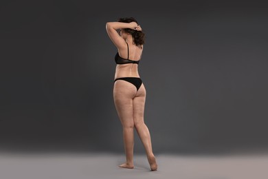 Photo of Beautiful woman in underwear on dark grey background. Cellulite problem