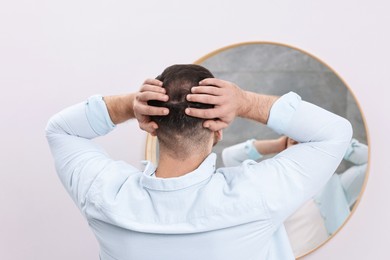 Photo of Baldness problem. Man with receding hairline near mirror in bathroom, back view