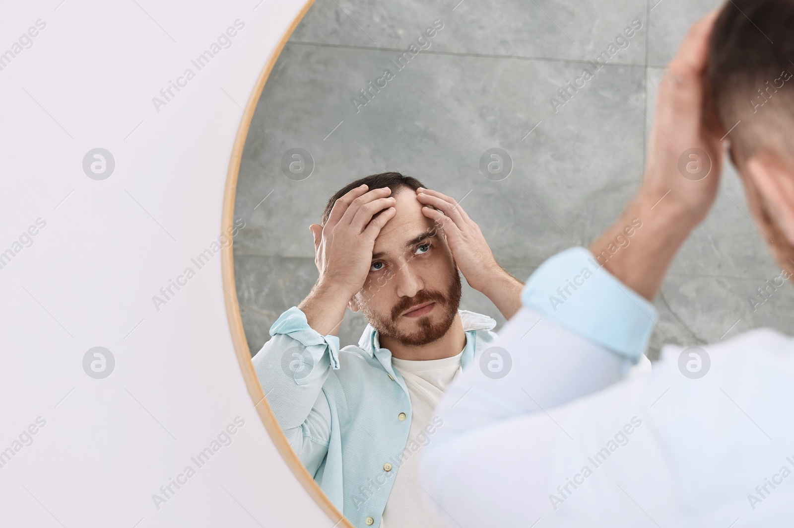 Photo of Baldness problem. Man with receding hairline near mirror in bathroom