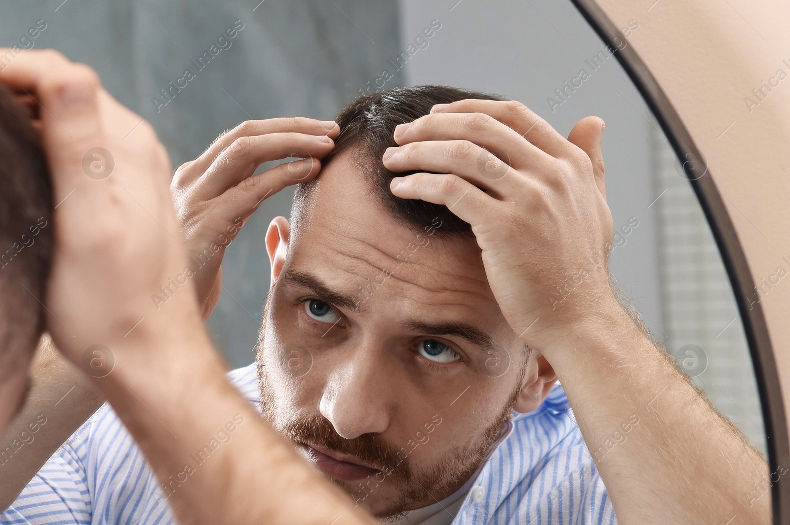 Photo of Baldness problem. Man with receding hairline near mirror in bathroom