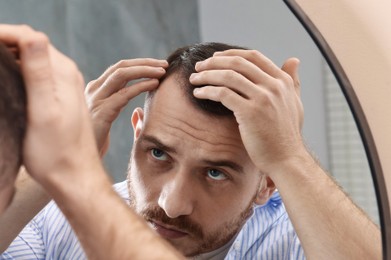 Photo of Baldness problem. Man with receding hairline near mirror in bathroom