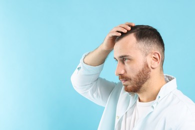 Baldness problem. Man with receding hairline on light blue background, space for text