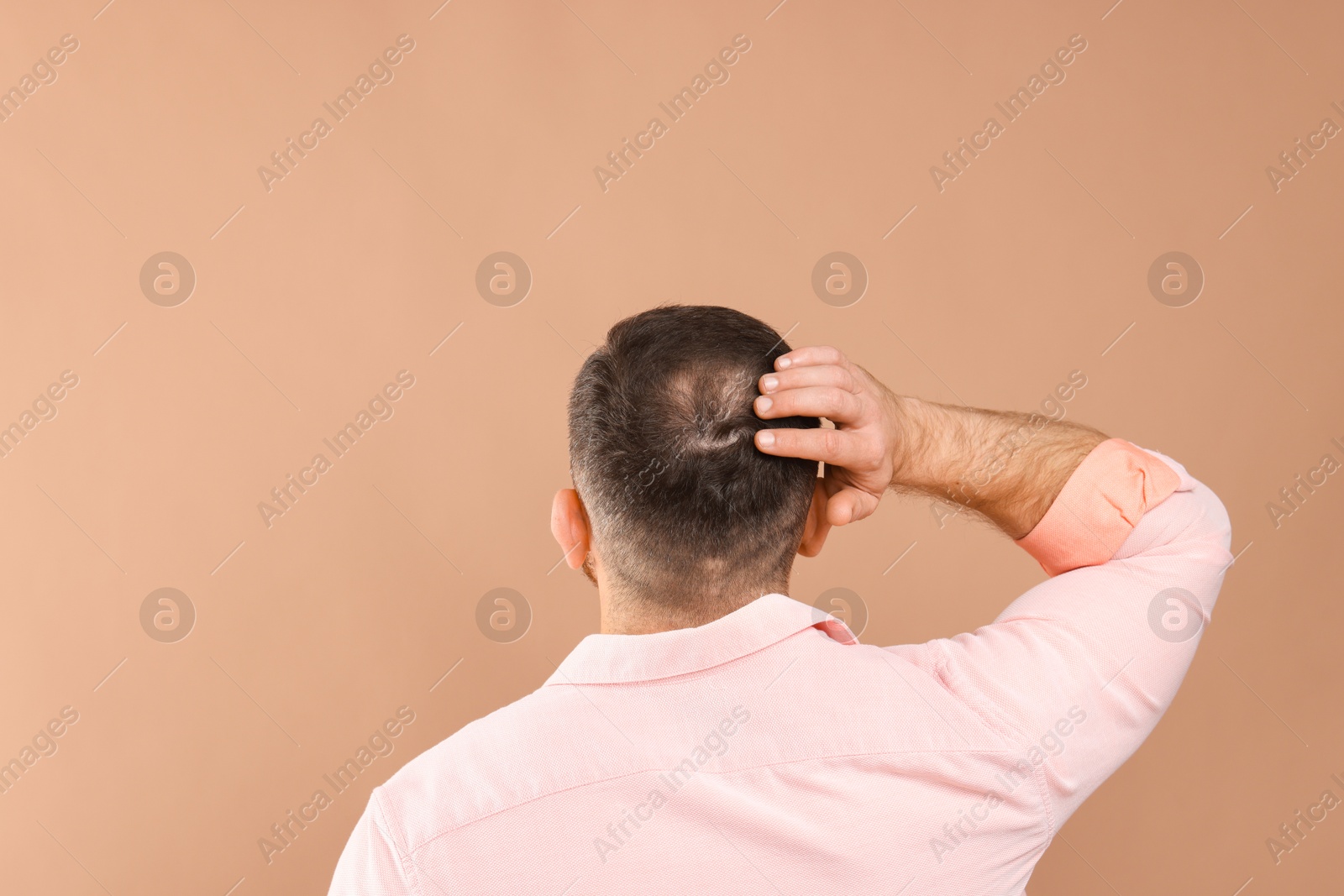 Photo of Baldness problem. Man with bald spot on beige background, back view. Space for text