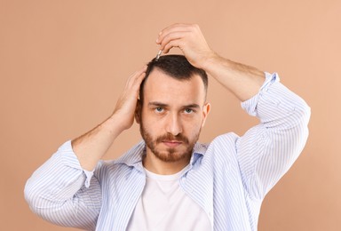 Photo of Baldness treatment. Man applying serum onto hair on beige background