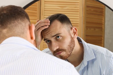 Photo of Baldness problem. Man with receding hairline near mirror at home