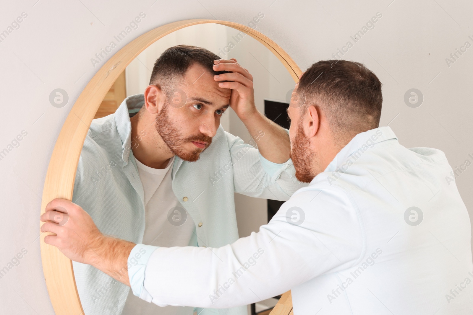 Photo of Baldness problem. Man with receding hairline near mirror at home