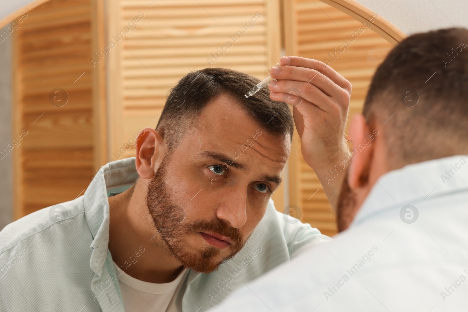 Photo of Baldness treatment. Man applying serum onto hair near mirror at home