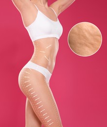 Image of Woman showing her beautiful body with smooth skin on crimson color background, closeup. Anti-cellulite massage lines on skin