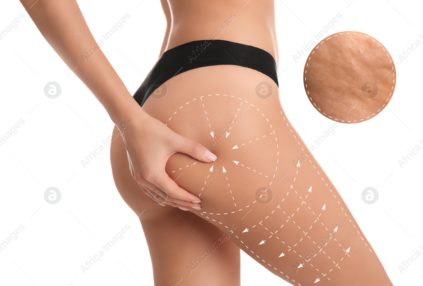 Image of Woman showing her beautiful body with smooth skin on white background, closeup. Anti-cellulite massage lines on skin