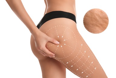 Image of Woman showing her beautiful body with smooth skin on white background, closeup. Anti-cellulite massage lines on skin