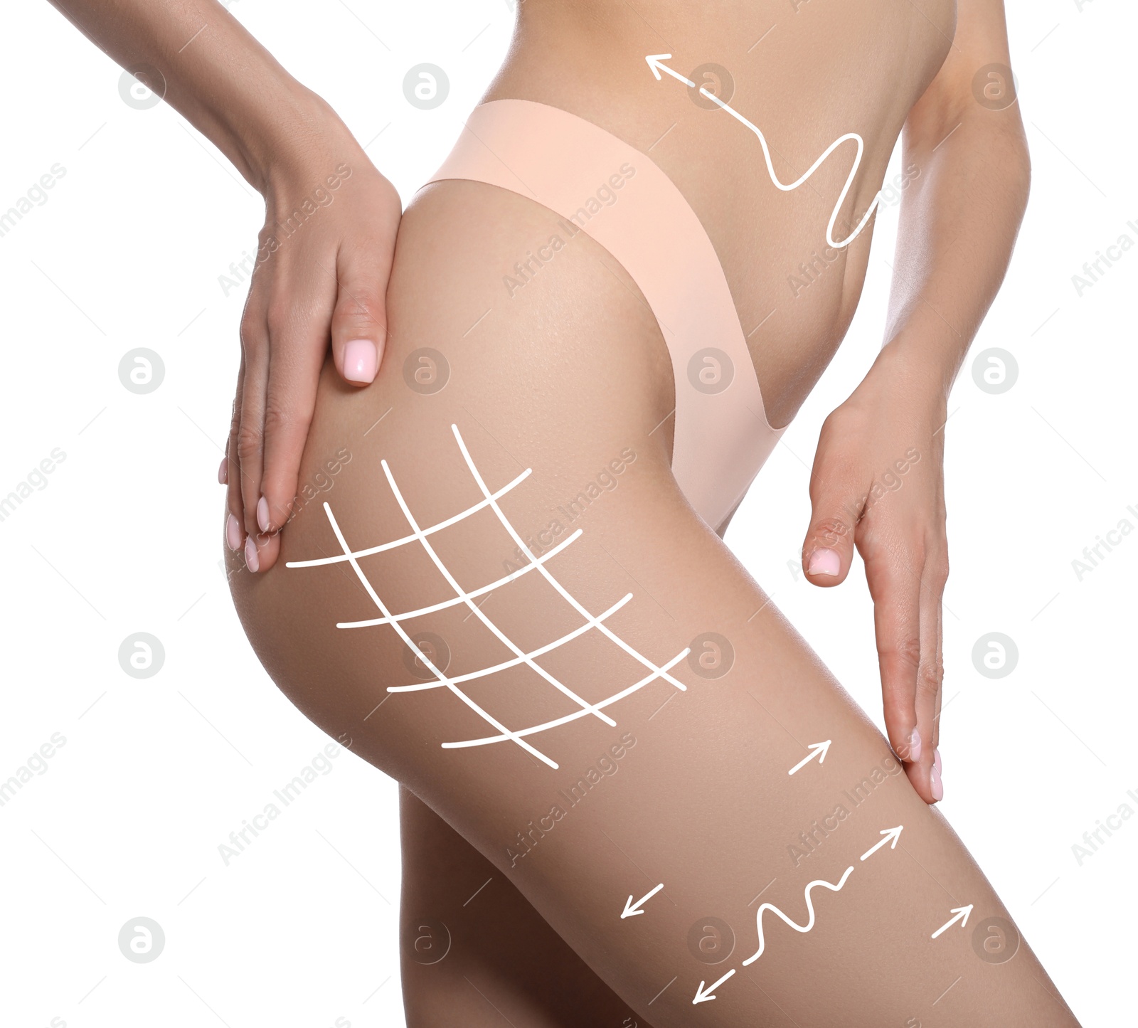 Image of Woman showing her beautiful body with smooth skin on white background, closeup. Lines of anti-cellulite massage or lifting on skin