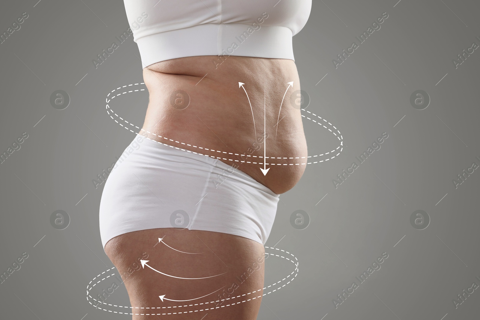 Image of Woman with excessive fat on grey background, closeup. Weight loss and anti-cellulite treatment, lifting or massage lines on skin