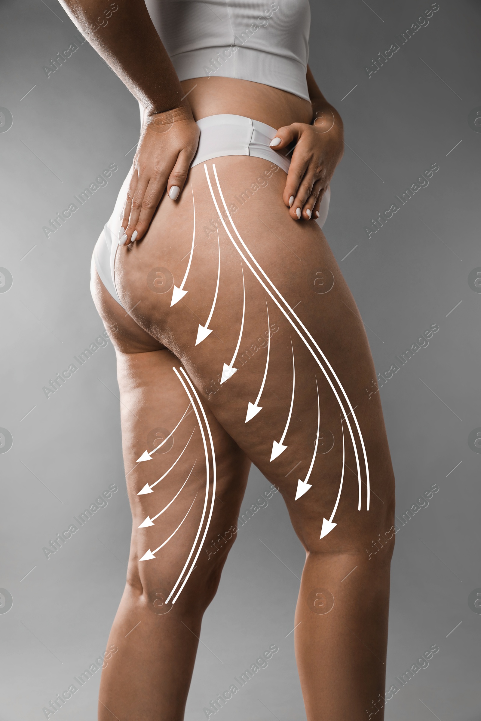 Image of Woman with orange peel skin on hips against grey background, closeup. Weight loss and anti-cellulite treatment, lifting or massage lines on skin