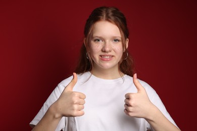 Beautiful teenage girl with freckles showing thumbs up on red background