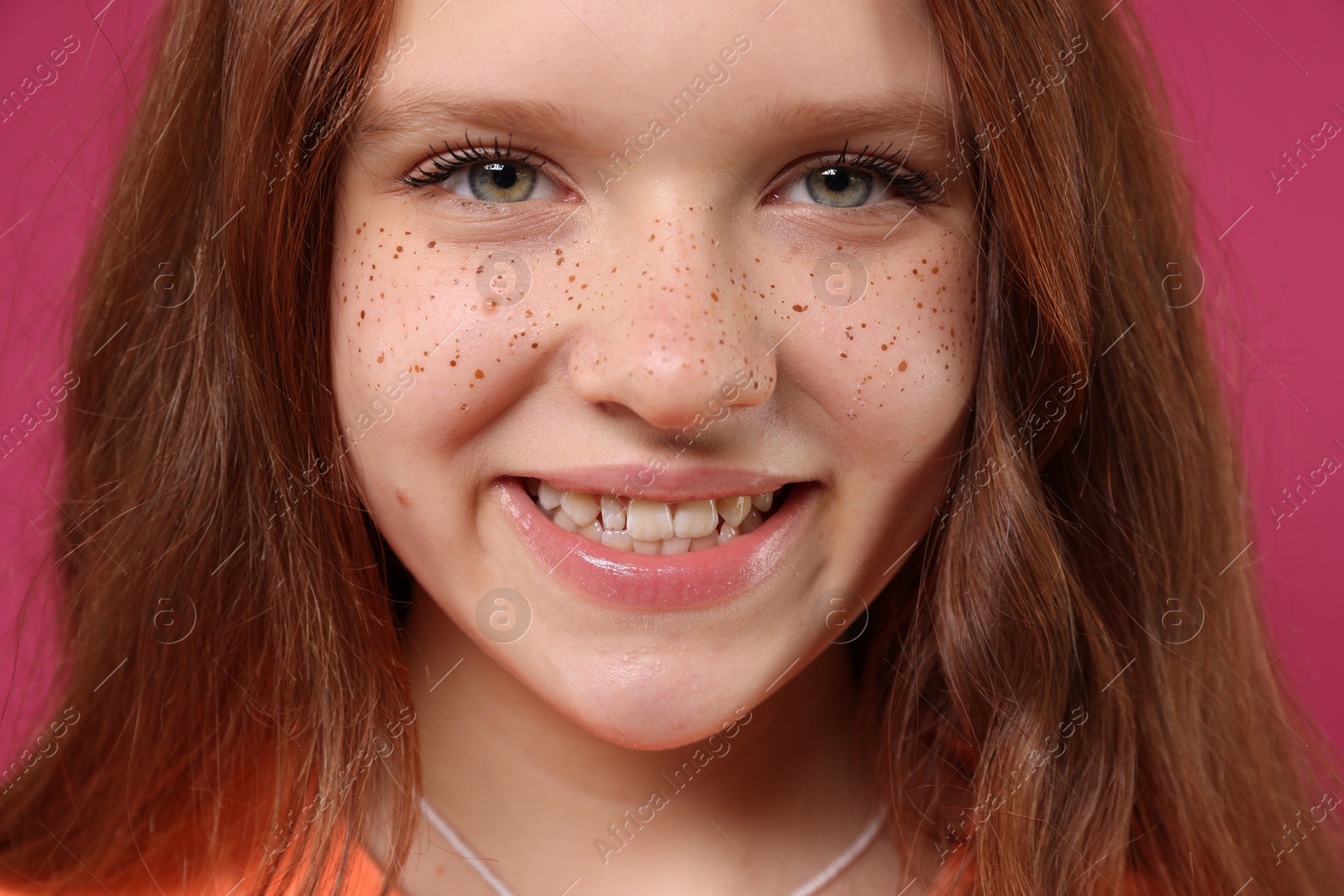 Photo of Beautiful teenage girl with freckles on pink background, closeup