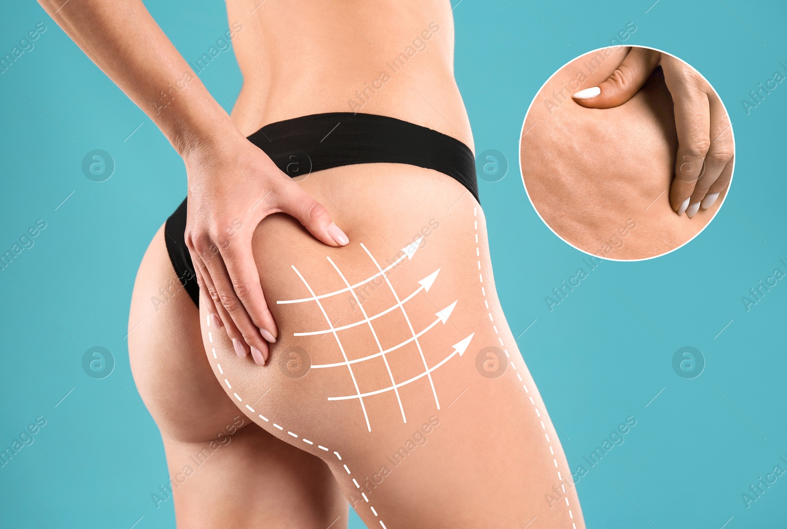 Image of Woman showing her beautiful body with smooth skin on light blue background, closeup. Anti-cellulite massage lines on skin