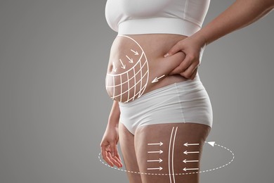 Image of Woman with excessive fat on grey background, closeup. Weight loss and anti-cellulite treatment, lifting or massage lines on skin