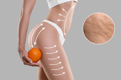 Image of Woman showing her beautiful body with smooth skin and holding orange on grey background, closeup. Lines of anti-cellulite massage on skin