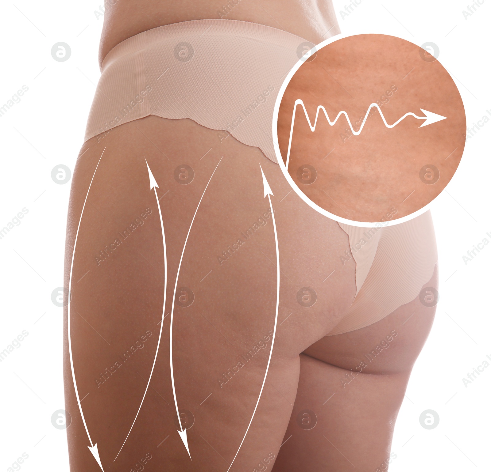 Image of Woman showing her beautiful body with smooth skin on white background, closeup. Weight loss and anti-cellulite treatment