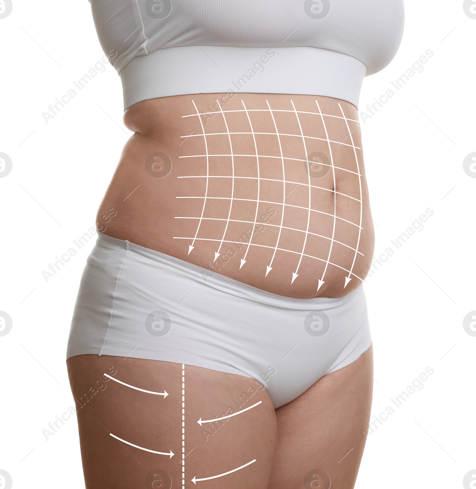 Image of Woman with excessive fat on white background, closeup. Weight loss and anti-cellulite treatment, lifting or massage lines on skin