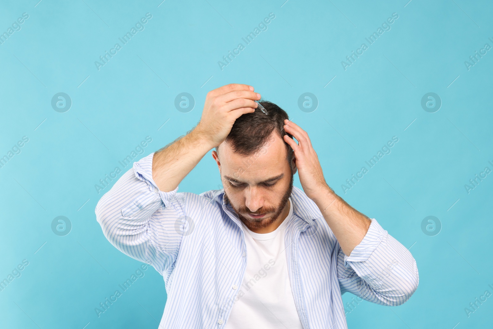 Photo of Baldness treatment. Man applying serum onto hair on light blue background