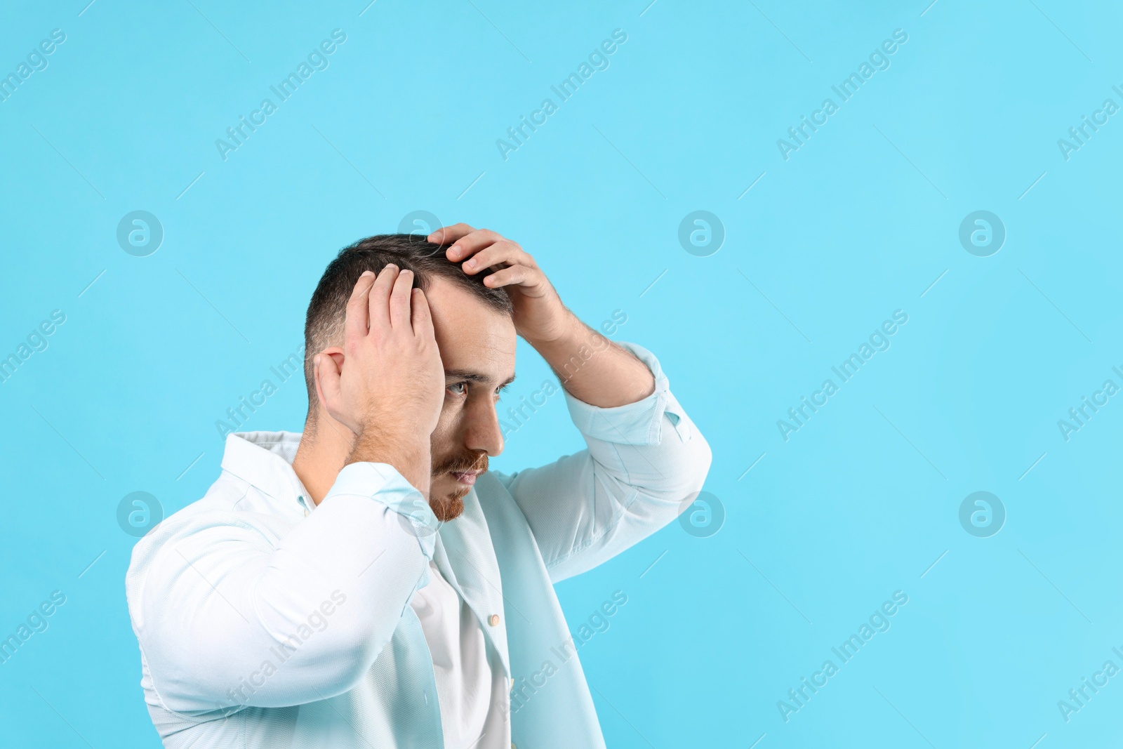 Photo of Baldness problem. Man with receding hairline on light blue background, space for text