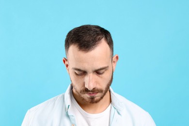 Photo of Baldness problem. Man with receding hairline on light blue background