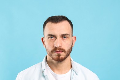 Photo of Baldness problem. Man with receding hairline on light blue background